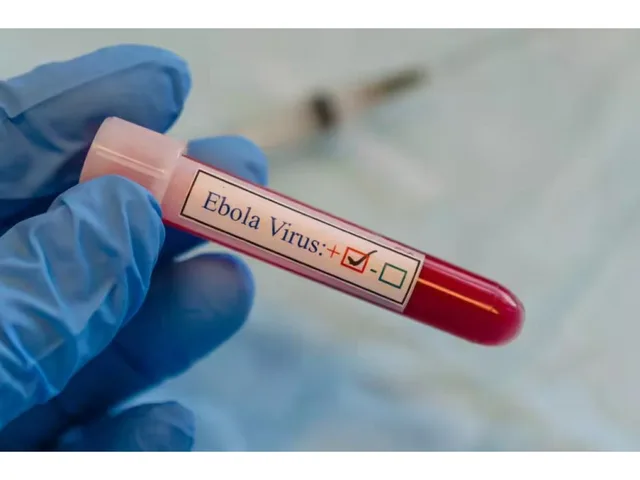 A gloved hand holding a blood sample tube labelled Ebola virus